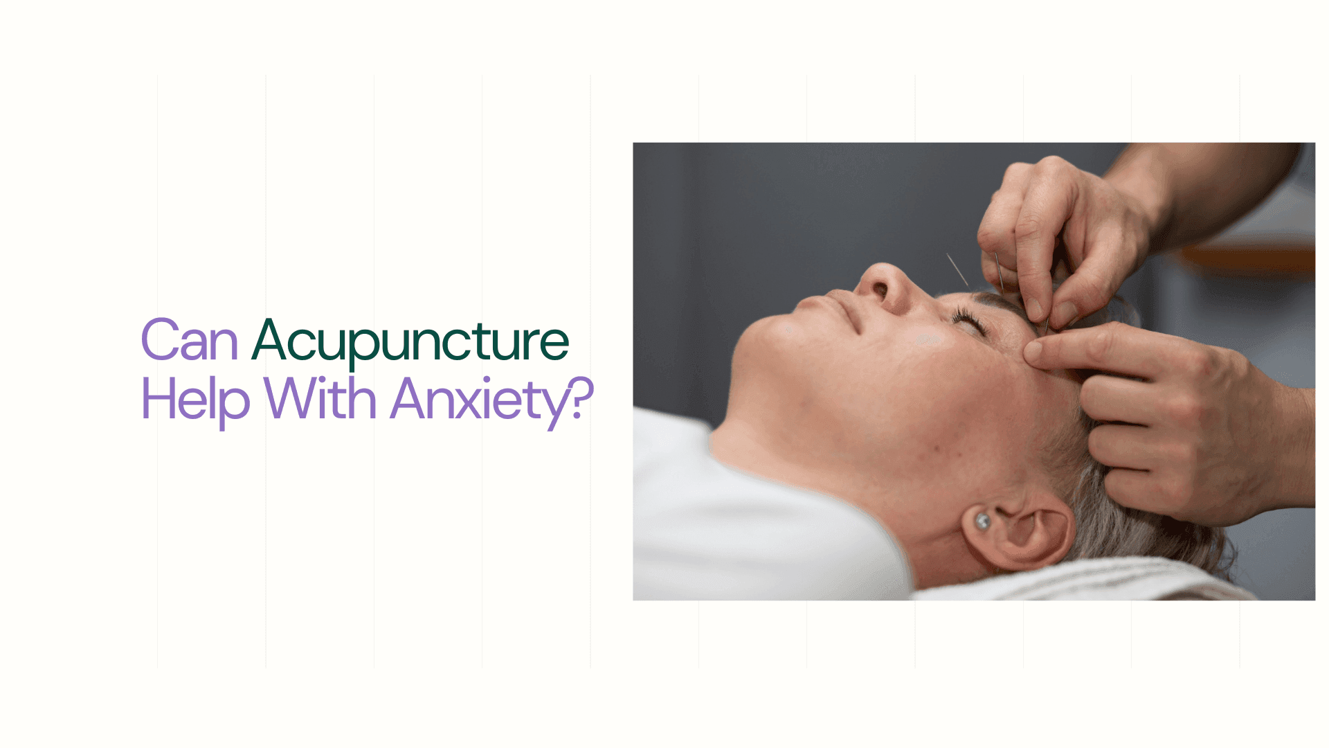 Japanese traditional medicine with needles on a face ear of a person - Can Acupuncture Help With Anxiety​?